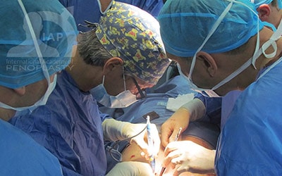 Master Course in Penoplasty, Photo Gallery