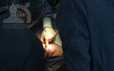 Master Course in Penoplasty, Photo Gallery